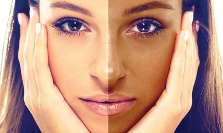 Merawat Kulit Gelap: Tips Perawatan Dan Kesehatan Kulit