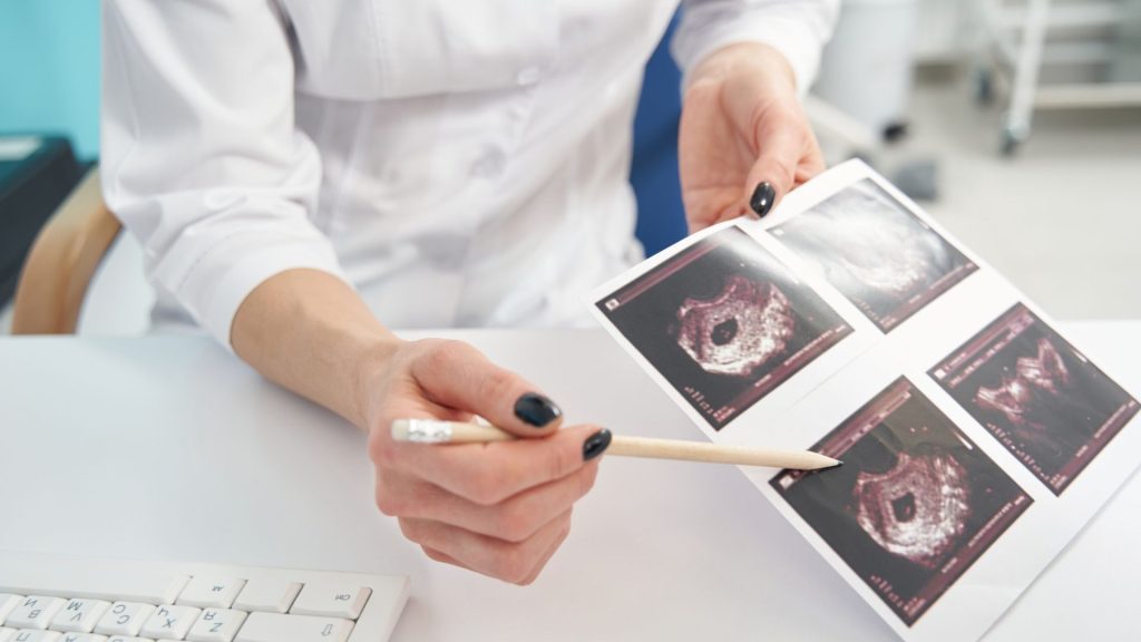 Perkembangan Janin Dari Trimester Ke Trimester