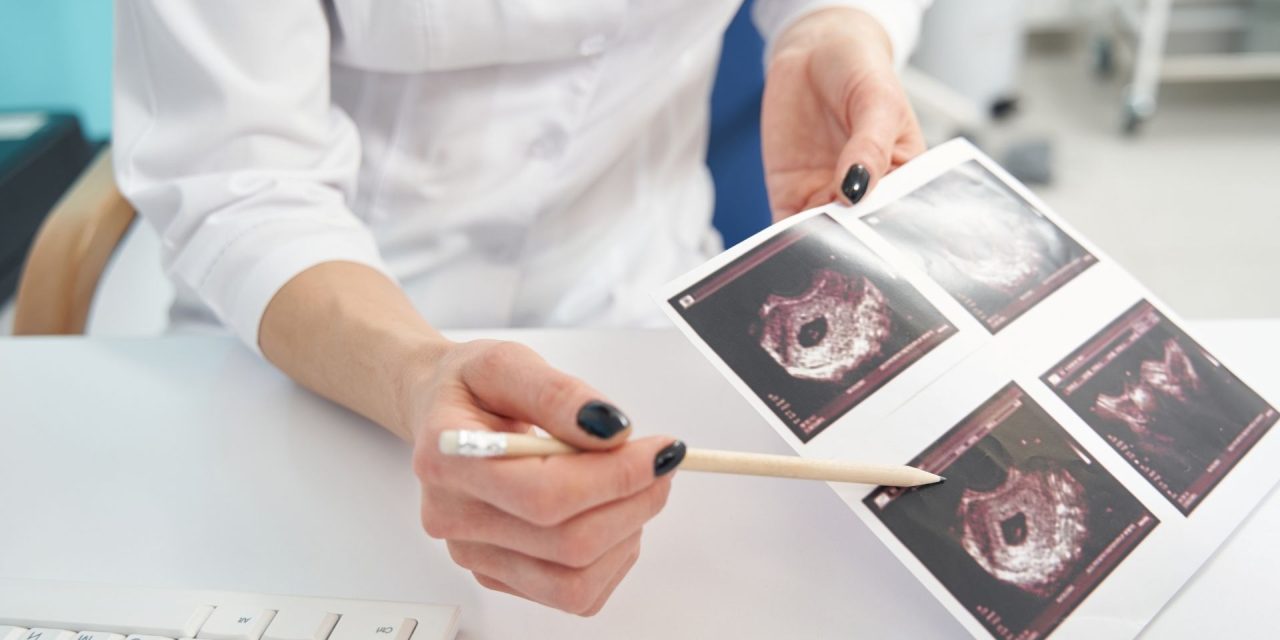 Perkembangan Janin Dari Trimester Ke Trimester