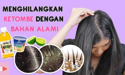 Cara Mengatasi Ketombe Membandel Secara Alami