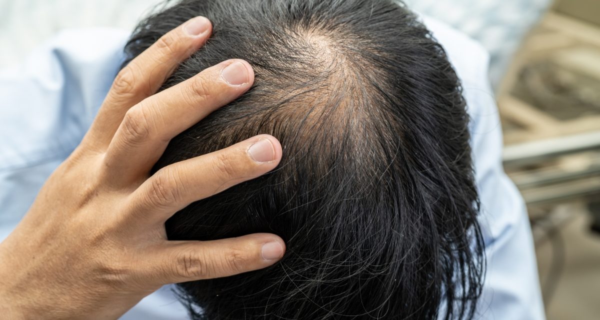Tips Efektif Merawat Rambut Agar Kuat Dan Tidak Mudah Rontok