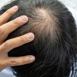 Tips Efektif Merawat Rambut Agar Kuat Dan Tidak Mudah Rontok