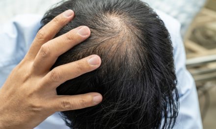Tips Efektif Merawat Rambut Agar Kuat Dan Tidak Mudah Rontok