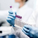Laboratorium Bergerak Memperluas Jangkauan Layanan Pengujian