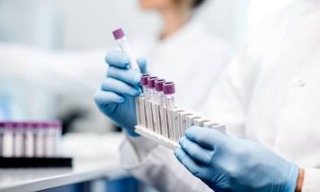 Laboratorium Bergerak Memperluas Jangkauan Layanan Pengujian
